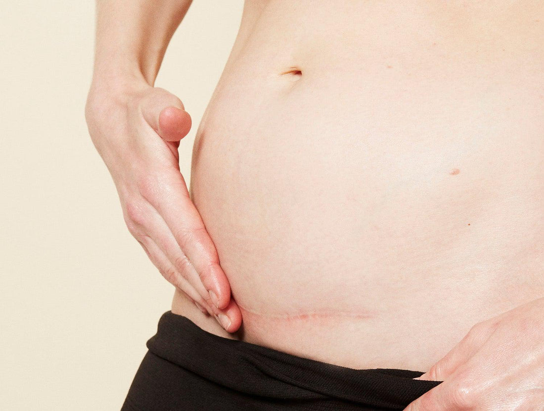 Momkind - Plejende olie - Kropspleje - MamaMilla